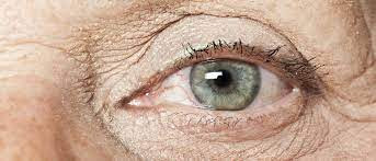 Betaxolol Hydrochloride